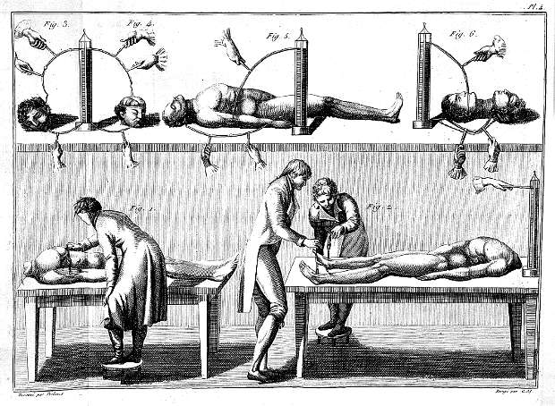 Illustrazione dal saggio di Giovani Aldini, Théorique et expérimental sur le galvanisme, avec une série d’expériences (1804) - via The public domain review
